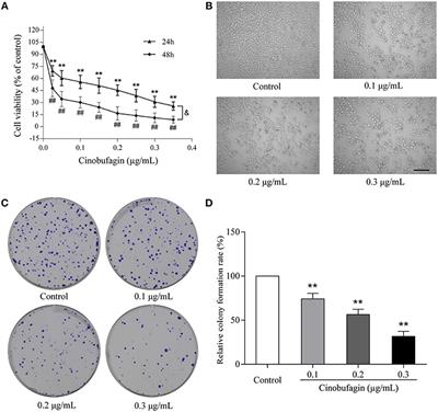 Cinobufagin Induces Cell Cycle Arrest at the G2/M Phase and Promotes Apoptosis in Malignant Melanoma Cells